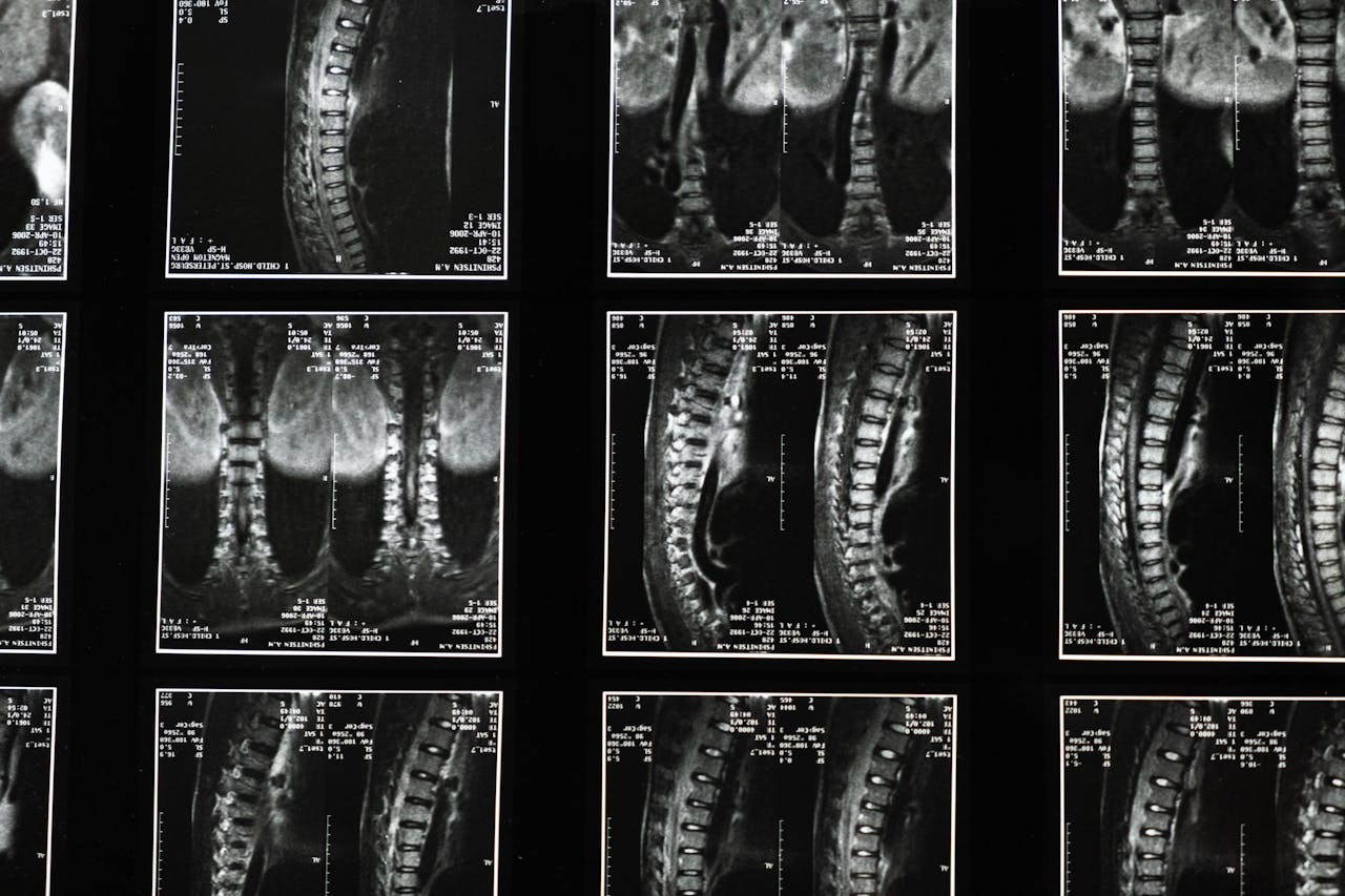 Mastering the First Impression: Your intriguing post title goes here Comprehensive spinal x-ray images, ideal for medical studies and diagnostics.
